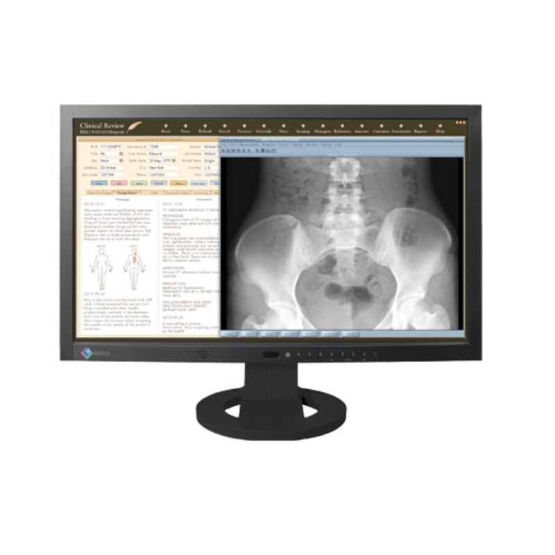 Eizo MS230W 23" DisplayPort VGA DVI