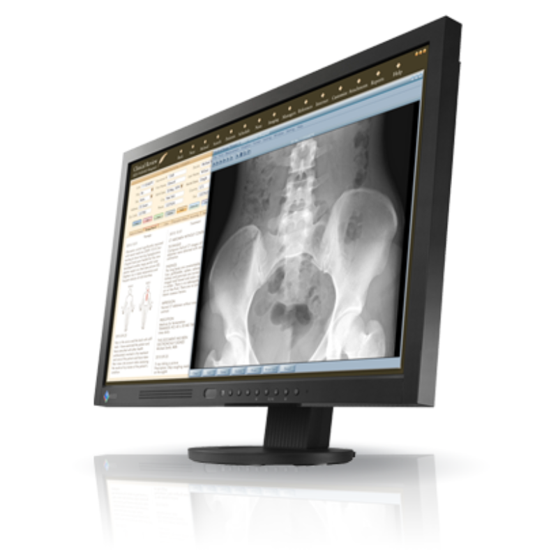 Eizo MS230W 23" DisplayPort VGA DVI